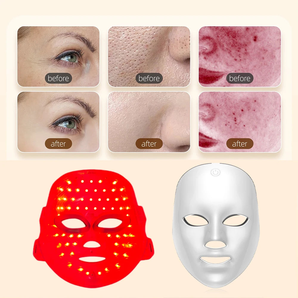 LED Light Therapy Face Mask – 7 Colors Photon Skin Rejuvenation & Lifting Beauty Device